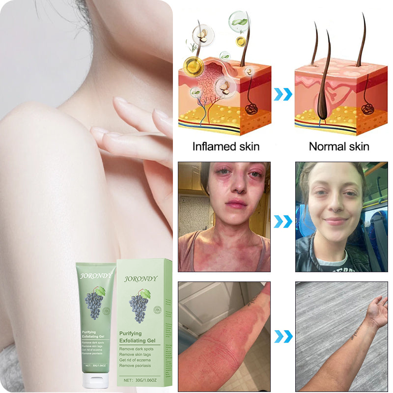 Čistiaci exfoliačný gél