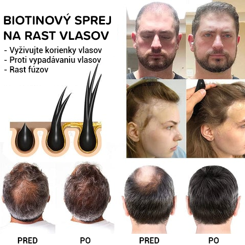 Sérum na rast vlasov s biotínom